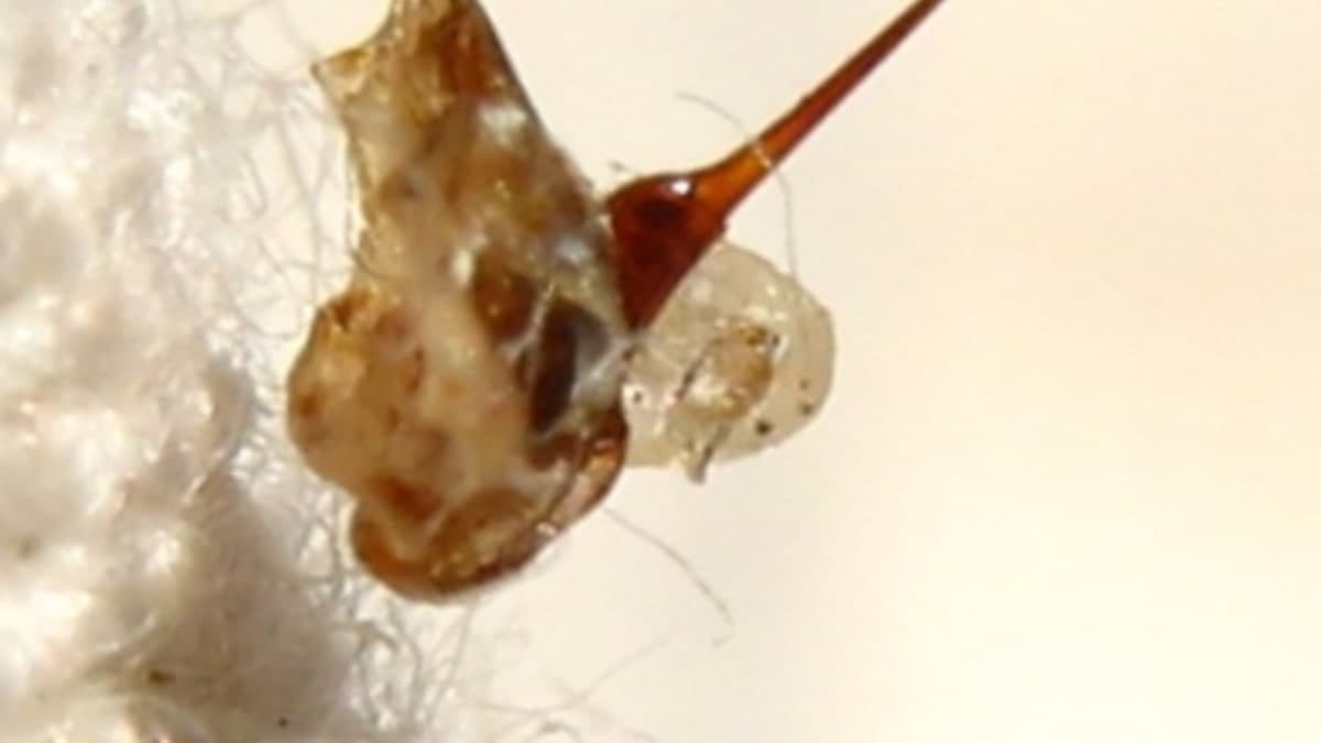 जरूरत की खबर: बगीचे या पार्क में मधुमक्खी ने मार दिया है डंक? अपनाएं ये 6 अचूक घरेलू उपाय और पहचानें 5 गंभीर खतरे के संकेत
